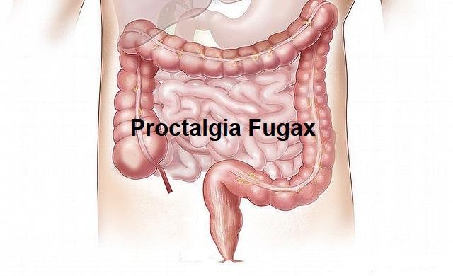 דיקור סיני לכאבים בפי הטבעת