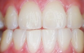 טיפולי חניכיים - איך לבחור את הרופא הנכון