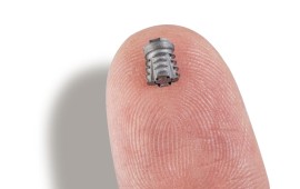 ברוח חג הפסח: שתלים בצורת פירמידה חוסכים הרמת סינוס והשתלת עצם שתל בגודל 3 גרגרי אוז, נפתח בעצם לצורת פירמידה